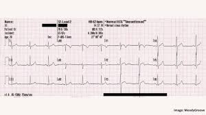 CERTIFICATE IN ECG TECHNICIAN